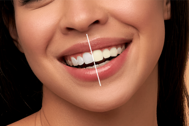 Dental Care Solutions In Your Milwaukee Neighborhood